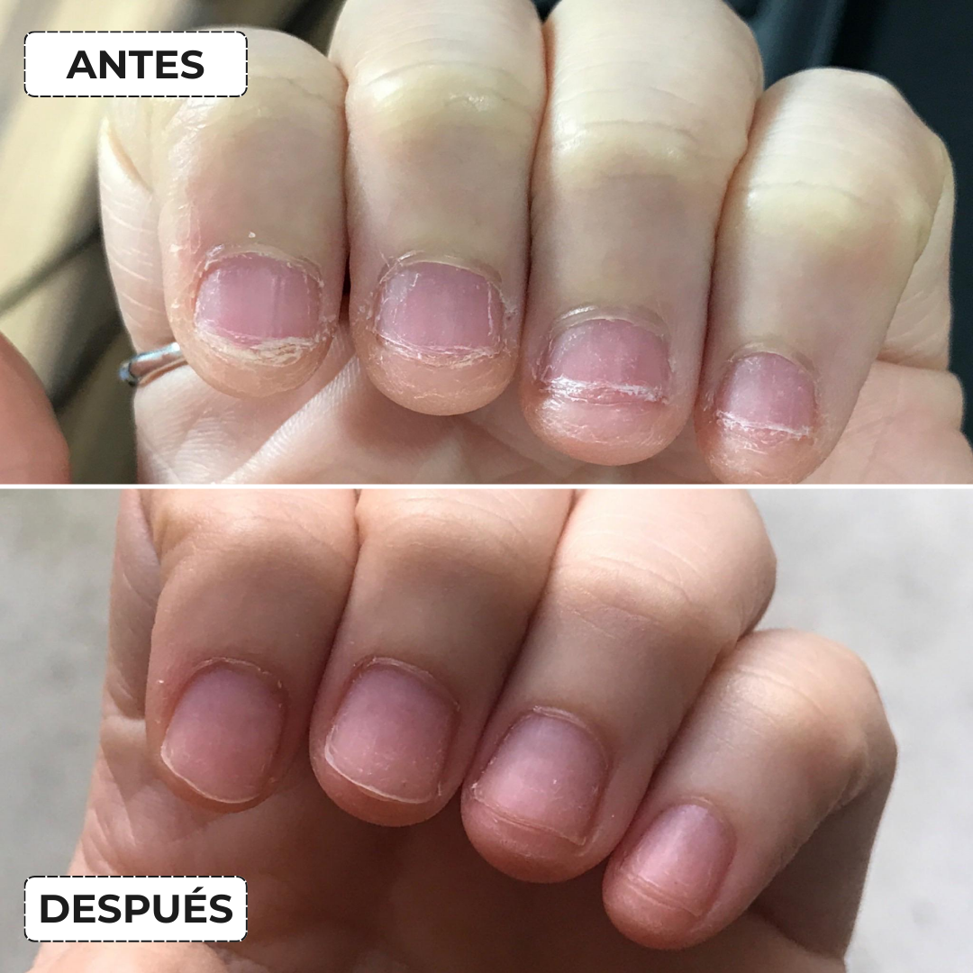 Anillo Giratorio Antiestrés