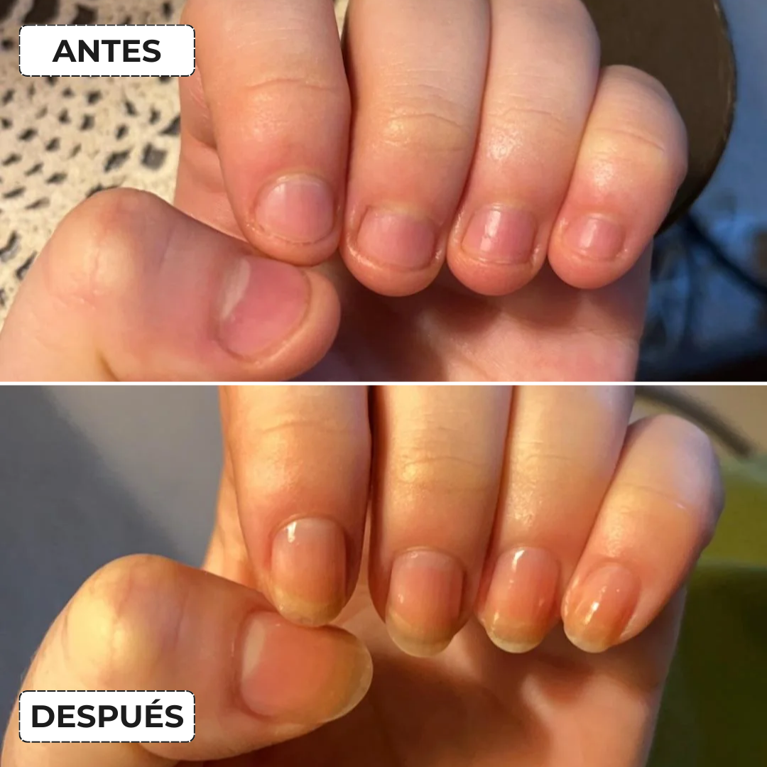 Anillo Giratorio Antiestrés