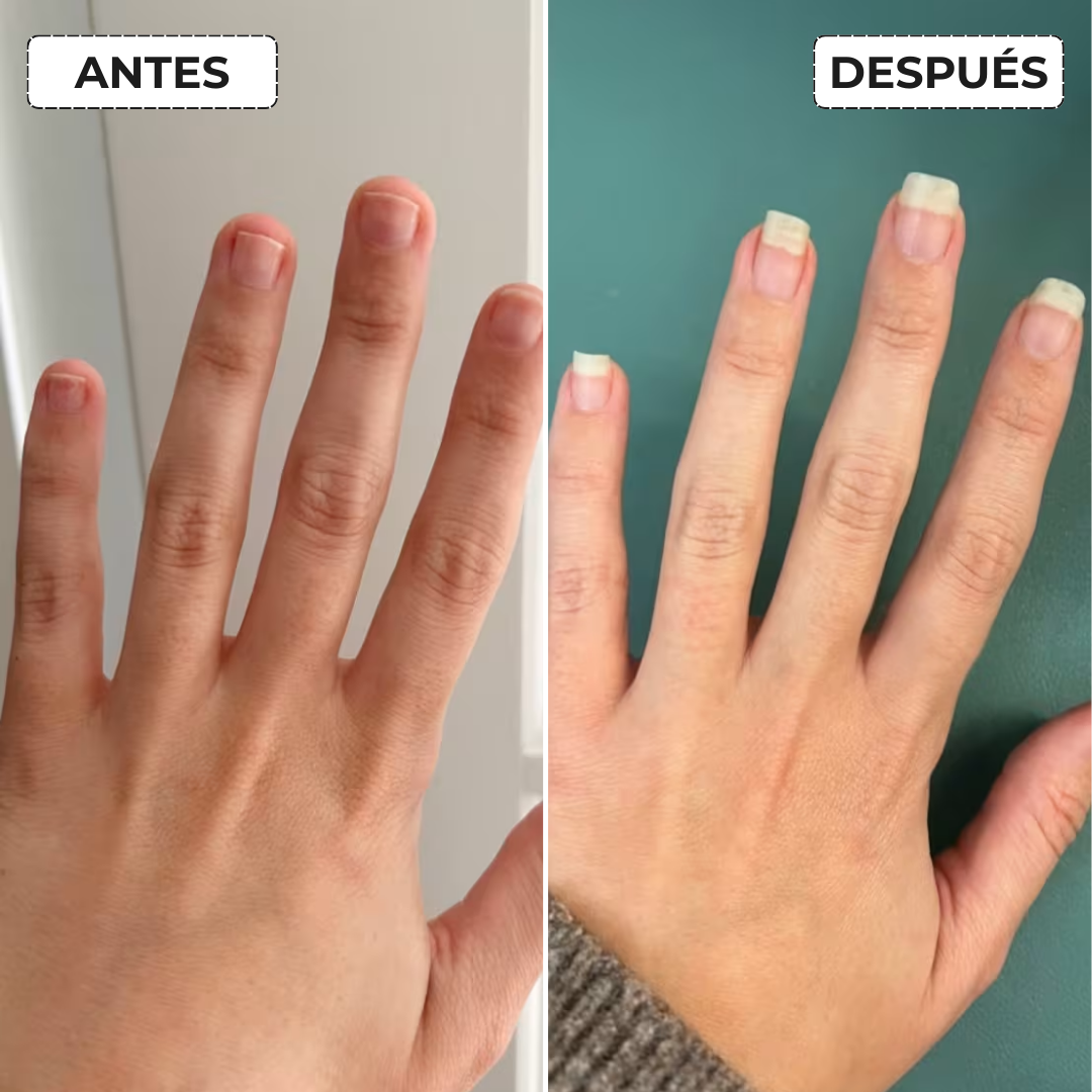 Anillo Giratorio Antiestrés